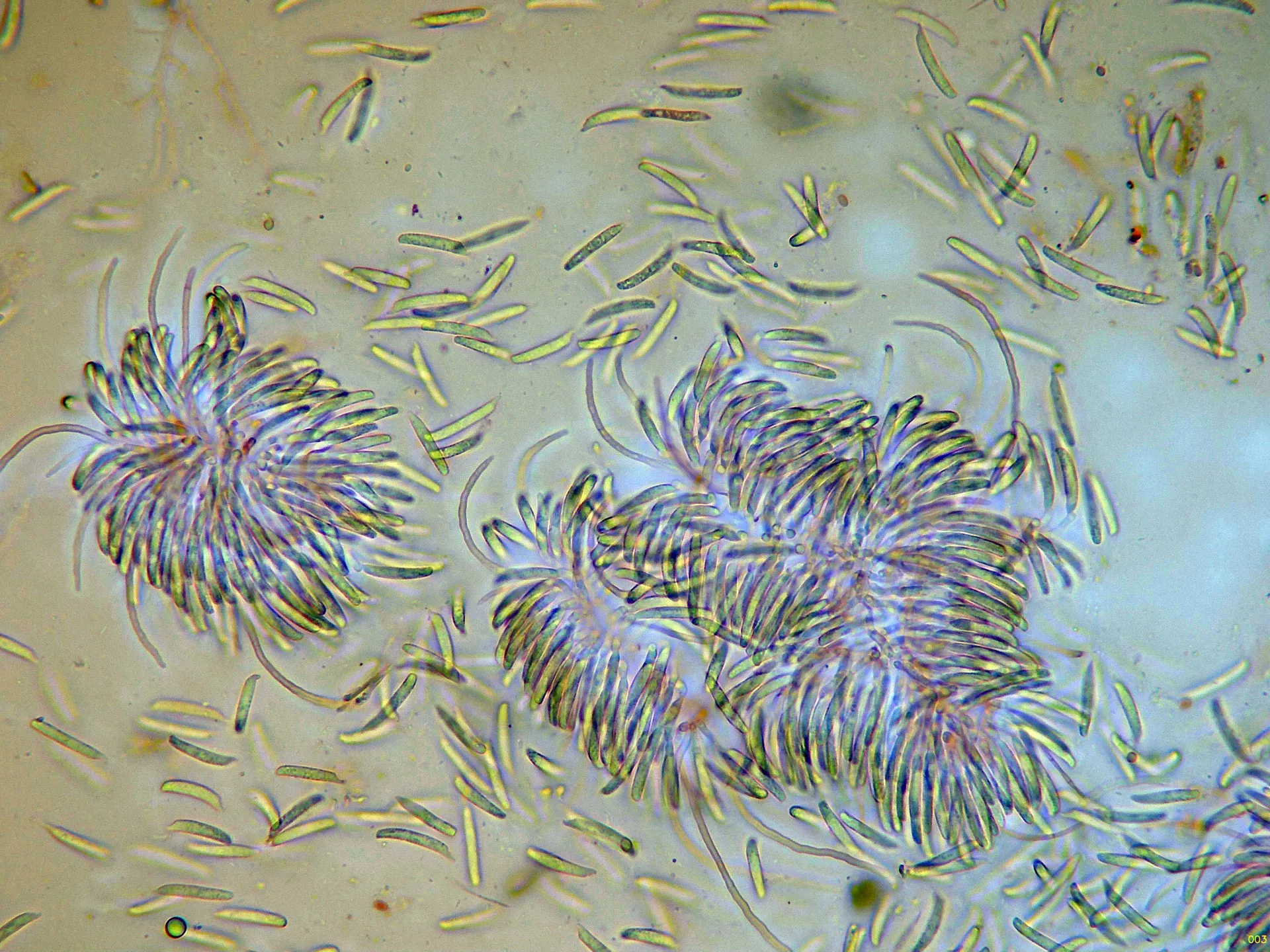 Microscopía de Infundibura adhaerens - 10 - Conidióforos x 400-003